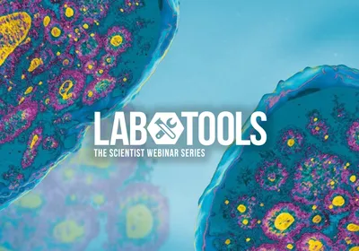 Organoid Models and 3D Imaging for Parkinson’s Disease Research Organoid Models and 3D Imaging for Parkinson’s Disease Research